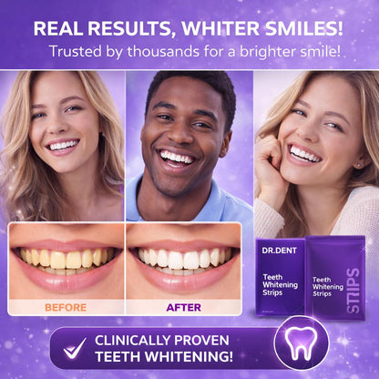 Whitening Strips